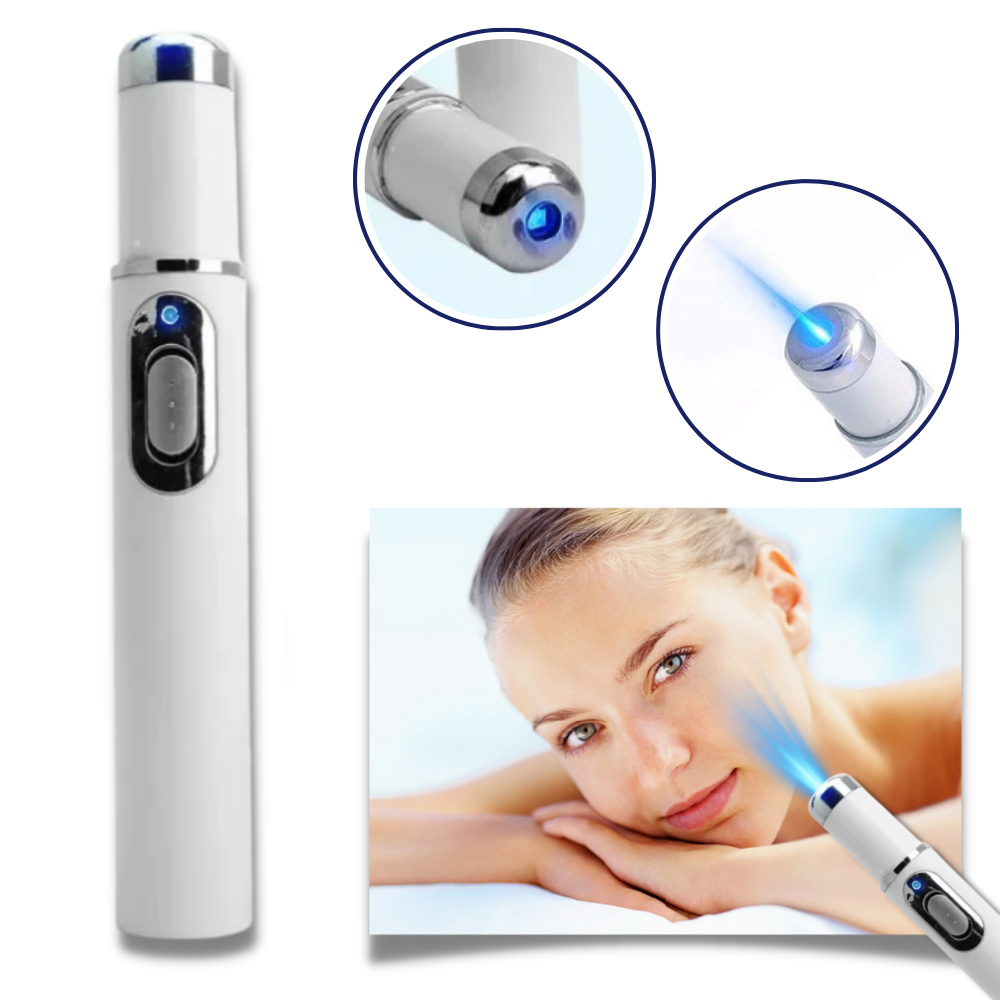 Blå laserpen til en klarere hudtone