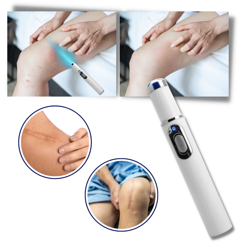 Blå laserpen til en klarere hudtone