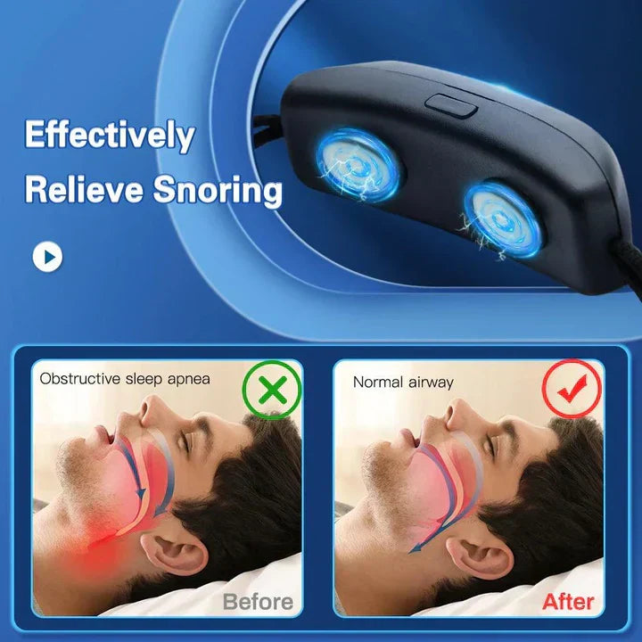 EMS-puls snorkestopper-enhed - Bærbart søvnhjælpemiddel