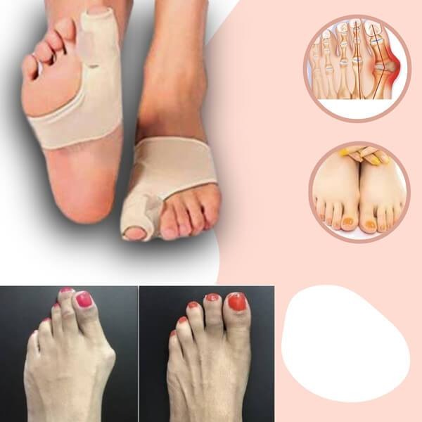 Knystkorrektor til smertelindring ved hallux valgus