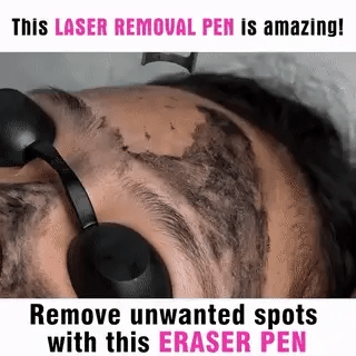 Picosekund-laserpen mod hudfejl