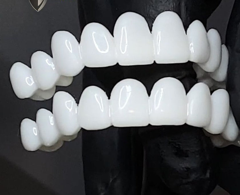 Snap-on kosmetiske facader | Øjeblikkelig dækning af ufuldkommenheder i smilet